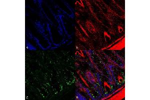 Immunohistochemistry analysis using Mouse Anti-O-GalNAc Monoclonal Antibody, Clone 9B9 (ABIN5067145). (O-GalNAC Antikörper)