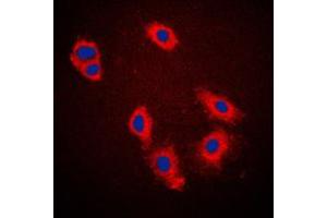 Immunofluorescent analysis of Caspase 9 staining in HeLa cells. (Caspase 9 Antikörper  (Center))