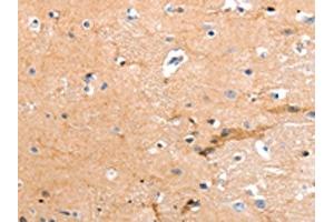 The image on the left is immunohistochemistry of paraffin-embedded Human brain tissue using ABIN7190856(GPR64 Antibody) at dilution 1/55, on the right is treated with synthetic peptide. (GPR64 Antikörper)