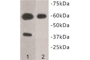 Western Blotting (WB) image for anti-Transmembrane Protein 57 (TMEM57) antibody (ABIN1854993) (TMEM57 Antikörper)