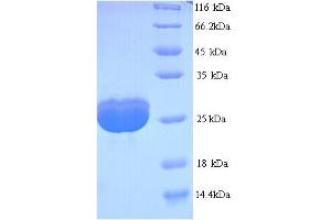 SDS-PAGE (SDS) image for Filaggrin (FLG) (AA 3838-4061), (partial) protein (His tag) (ABIN5713456) (Filaggrin Protein (FLG) (AA 3838-4061, partial) (His tag))