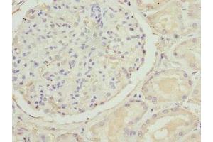 Immunohistochemistry of paraffin-embedded human kidney tissue using ABIN7170139 at dilution of 1:100 (SLC22A11 Antikörper  (AA 40-150))