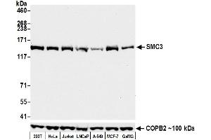 Western Blotting (WB) image for anti-Structural Maintenance of Chromosomes 3 (SMC3) (AA 1175-1217) antibody (ABIN7453329) (Rekombinanter SMC3 Antikörper  (AA 1175-1217))