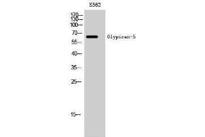 Western Blotting (WB) image for anti-Glypican 5 (GPC5) (Internal Region) antibody (ABIN3175297) (GPC5 Antikörper  (Internal Region))