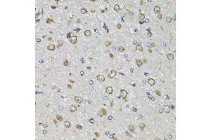 Immunohistochemistry of paraffin-embedded rat brain using FGF2 antibody. (FGF2 Antikörper)