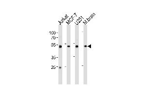 ENOA Antibody (C-term) (ABIN1882077 and ABIN2839495) western blot analysis in Jurkat,MCF-7, cell line and mouse brain tissue lysates (35 μg/lane). (ENO1 Antikörper  (C-Term))