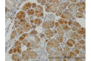 Image no. 5 for anti-Glutathione Reductase (GSR) (AA 413-523) antibody (ABIN598715) (Glutathione Reductase Antikörper  (AA 413-523))