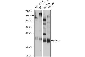 Western blot analysis of extracts of various cell lines, using PRRG2 antibody (ABIN7269558) at 1:1000 dilution. (PRRG2 Antikörper  (AA 1-179))