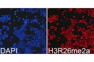 Immunofluorescence analysis of 293T cell using H3R26 me2a antibody. (Histone 3 Antikörper  (H3R26me2a))