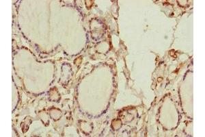 Immunohistochemistry of paraffin-embedded human thyroid tissue using ABIN7170585 at dilution of 1:100 (SPICE1 Antikörper  (AA 1-220))