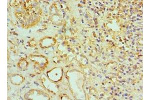 Immunohistochemistry of paraffin-embedded human kidney tissue using ABIN7159916 at dilution of 1:100 (TOMM2 (AA 20-145) Antikörper)