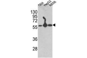 Western blot analysis of AP17615PU-N P4HB antibody (C-term) in CEM,HepG2, A2058 cell line lysates (35 µg/lane). (P4HB Antikörper  (C-Term))