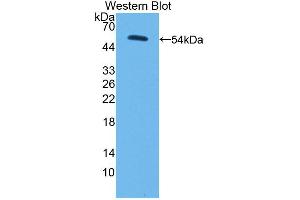 Figure. (PC Antikörper  (AA 36-486))