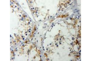 Used in DAB staining on fromalin fixed paraffin-embedded testis tissue (IGF2 Antikörper  (AA 25-91))