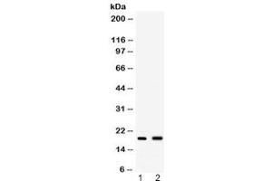 Western blot testing of 1) mouse spleen and 2) mouse liver lysate with PYY antibody at 0.
