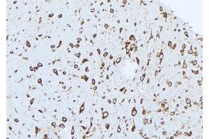 ABIN6273036 at 1/100 staining Mouse brain tissue by IHC-P. (Complexin 1 Antikörper  (N-Term))
