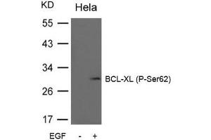 Western blot analysis of extracts from Hela cells untreated or treated with EGF using BCL-XL (Phospho-Ser62) Antibody.
