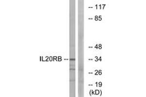 Western blot analysis of extracts from HeLa cells, using IL20RB Antibody.