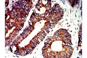 Immunohistochemistry (IHC) image for anti-BCL2-Antagonist/killer 1 (BAK1) (AA 29-187) antibody (ABIN5611250)