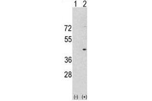 Western Blotting (WB) image for anti-Aurora Kinase A (AURKA) (AA 364-392) antibody (ABIN3030073)