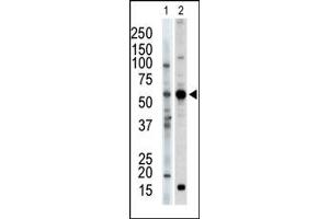 Image no. 1 for anti-Protein Kinase C and Casein Kinase Substrate in Neurons 2 (PACSIN2) (C-Term) antibody (ABIN360555) (PACSIN2 Antikörper  (C-Term))
