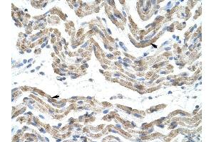SFRS10 antibody was used for immunohistochemistry at a concentration of 4-8 ug/ml to stain Skeletal muscle cells (arrows) in Human Muscle. (TRA2B Antikörper)