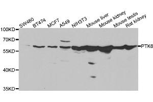 Western blot analysis of extracts of various cell lines, using PTK6 antibody. (PTK6 Antikörper)