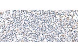 Immunohistochemistry of paraffin-embedded Human tonsil tissue using PAM16 Polyclonal Antibody at dilution of 1:60(x200) (MAGMAS Antikörper)