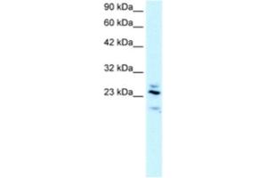 Western Blotting (WB) image for anti-Regulator of G-Protein Signaling 20 (RGS20) antibody (ABIN2460854) (RGS20 Antikörper)