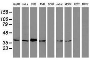 Image no. 3 for anti-Melanoma Antigen Family B, 1 (MAGEB1) antibody (ABIN1499266) (MAGEB1 Antikörper)