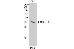 Western Blotting (WB) image for anti-NF-kappa-B inhibitor beta (NFKBIB) (pThr19) antibody (ABIN3180433) (NFKBIB Antikörper  (pThr19))