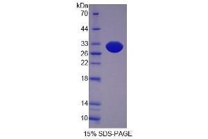 SDS-PAGE analysis of Mouse SCEL Protein. (SCEL Protein)