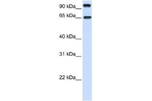 WB Suggested Anti-NTRK3 Antibody Titration:  0. (NTRK3 Antikörper  (C-Term))