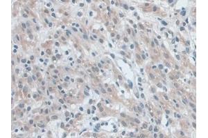 Immunohistochemistry (IHC) image for anti-NLR Family, Pyrin Domain Containing 3 (NLRP3) (AA 671-1033) antibody (ABIN7443710)