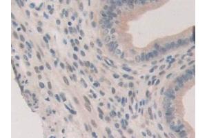Detection of ERa in Mouse Uterus Tissue using Polyclonal Antibody to Estrogen Receptor Alpha (ERa) (Estrogen Receptor alpha Antikörper  (AA 233-483))