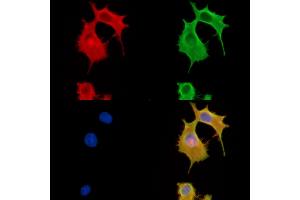 ABIN6260322 and ABIN6279883 staining HepG2 cells by IF/ICC. (BTF3L4 Antikörper  (Internal Region))