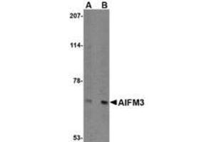 Image no. 1 for anti-Apoptosis-Inducing Factor, Mitochondrion-Associated, 3 (AIFM3) (N-Term) antibody (ABIN1494348) (AIFM3 Antikörper  (N-Term))