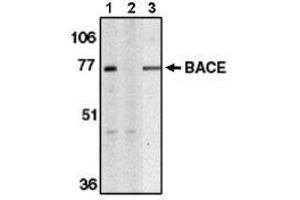 Image no. 1 for anti-Beta-secretase 1 (BACE1) (AA 485-501) antibody (ABIN264995) (BACE1 Antikörper  (AA 485-501))