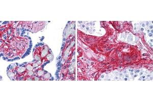 Anti collagen VI antibody (1:400 45 min RT) showed strong staining in FFPE sections of human placenta (Left) with red staining of stromal and extracellular spaces, and in testis (Right) with staining of extracellular spaces between seminiferous tubules). (COL6 Antikörper  (Biotin))