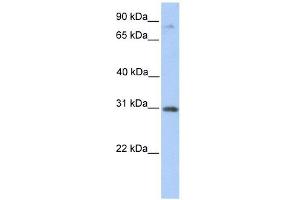 ABHD13 antibody used at 1 ug/ml to detect target protein. (ABHD13 Antikörper  (C-Term))