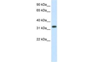 Western Blotting (WB) image for anti-E3 Ubiquitin-Protein Ligase SIAH1 (SIAH1) antibody (ABIN2461673) (SIAH1 Antikörper)