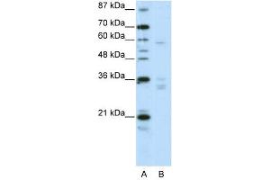 ZNF440 antibody (20R-1234) used at 0. (ZNF440 Antikörper  (N-Term))