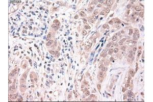 Immunohistochemical staining of paraffin-embedded kidney using anti-Trim33 (ABIN2452534) mouse monoclonal antibody. (TRIM33 Antikörper  (AA 887-1046))