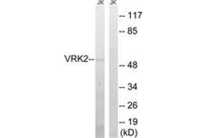Western Blotting (WB) image for anti-Vaccinia Related Kinase 2 (VRK2) (AA 171-220) antibody (ABIN2890623) (VRK2 Antikörper  (AA 171-220))