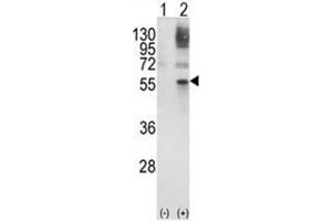 Western blot analysis of GATA2 (arrow) using rabbit polyclonal GATA2 Antibody (Center) . (GATA2 Antikörper  (Middle Region))
