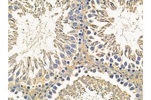 ABIN7095634 and ABIN7099696 at 1/100 staining rat testis tissue by IHC-P.