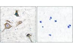 Immunohistochemistry analysis of paraffin-embedded human brain tissue, using MMP-16 Antibody. (MMP16 Antikörper  (AA 551-600))
