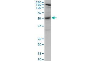 AKT1 monoclonal antibody (M03), clone 2E11. (AKT1 Antikörper  (AA 1-480))