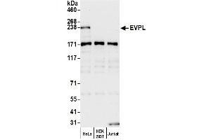 anti-Envoplakin (EVPL) (AA 1275-1325) antibody