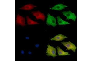 anti-Family with Sequence Similarity 114, Member A2 (FAM114A2) antibody
